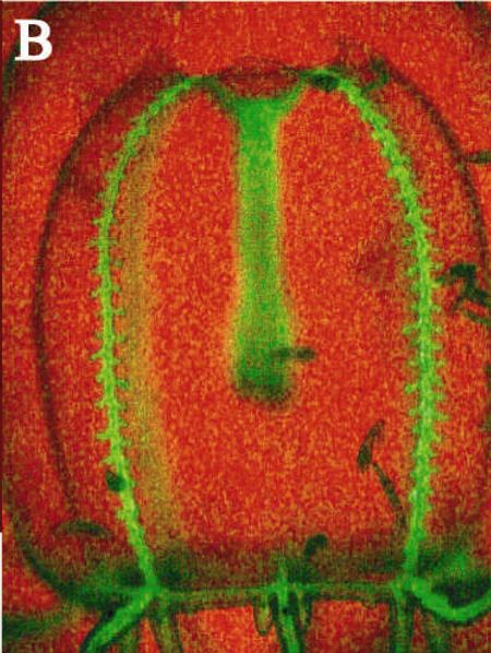 VARIOUS DISTRIBUTION PATTERNS OFGREEN FLUORESCENCE IN SMALLHYDROMEDUSAE Plate.3